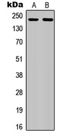 CD115 (Phospho-Y809) Rabbit Polyclonal Antibody