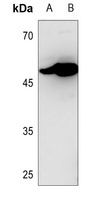 CD116 Antibody