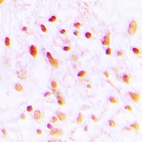 CTBP1 Antibody