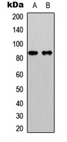 Beta-catenin (Phospho-S33) Rabbit Polyclonal Antibody