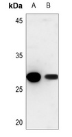Cathepsin Z Rabbit Polyclonal Antibody