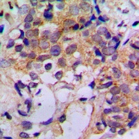 Cathepsin Z Rabbit Polyclonal Antibody