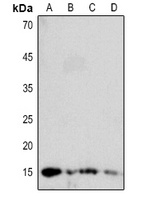 DBI Rabbit Polyclonal Antibody