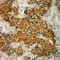 DBI Rabbit Polyclonal Antibody