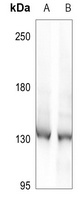 DDX8 Rabbit Polyclonal Antibody