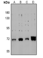 CRMP2 (Phospho-S522) Rabbit Polyclonal Antibody