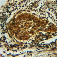 CRMP2 (Phospho-S522) Rabbit Polyclonal Antibody