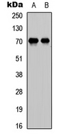 E2F1 Rabbit Polyclonal Antibody