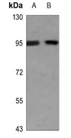 EEF2 (Phospho-T56) Rabbit Polyclonal Antibody