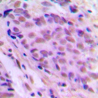 MEN Rabbit Polyclonal Antibody