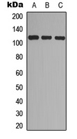 EPHA7 (Phospho-Y608) Rabbit Polyclonal Antibody