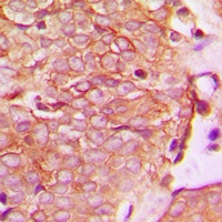 HER2 (Phospho-Y1221/Y1222) Rabbit Polyclonal Antibody