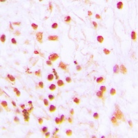 ERCC6 Antibody