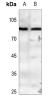 PE2 Rabbit Polyclonal Antibody