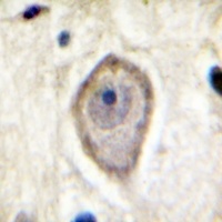 CD142 (Phospho-S290) Rabbit Polyclonal Antibody