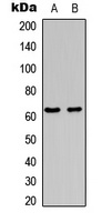 c-FOS (Phospho-S362) Rabbit Polyclonal Antibody