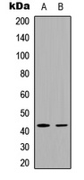 FOSL1 Rabbit Polyclonal Antibody