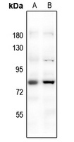 FOXO1 Rabbit Polyclonal Antibody