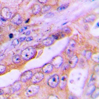 FOXO1 Rabbit Polyclonal Antibody