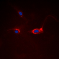 FOXO1 Rabbit Polyclonal Antibody