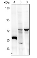 FRS2 (Phospho-Y436) Rabbit Polyclonal Antibody