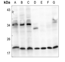 FSH beta Rabbit Polyclonal Antibody