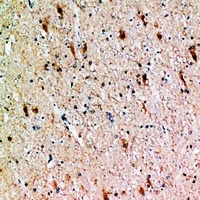 FSH beta Rabbit Polyclonal Antibody