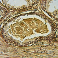 GAB1 (Phospho-Y627) Rabbit Polyclonal Antibody