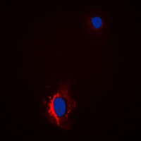 GAB1 (Phospho-Y627) Rabbit Polyclonal Antibody