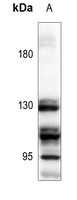 GABBR1 Rabbit Polyclonal Antibody