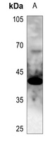 GATA1 Rabbit Polyclonal Antibody