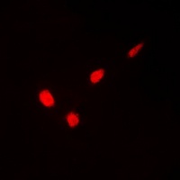 GATA1 (Phospho-S310) Rabbit Polyclonal Antibody