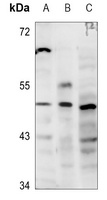 GATA3 Rabbit Polyclonal Antibody