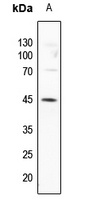 GATA3 (Phospho-S308) Rabbit Polyclonal Antibody