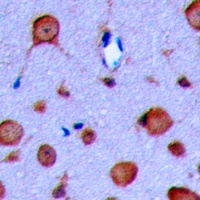 GLP-1 Receptor Antibody