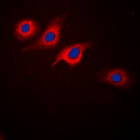 GLP-1 Receptor Antibody