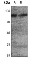 GLUR2 (Phospho-S880) Rabbit Polyclonal Antibody