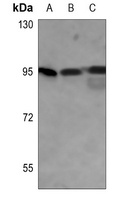 GYS1 (Phospho-S645) Rabbit Polyclonal Antibody