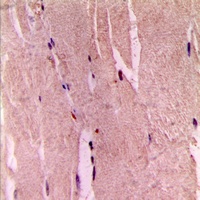 GYS1 (Phospho-S645) Rabbit Polyclonal Antibody