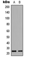 HAND1 Rabbit Polyclonal Antibody