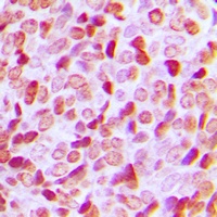 Histone Deacetylase 1 Rabbit Polyclonal Antibody