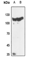 Histone Deacetylase 5/9 Rabbit Polyclonal Antibody