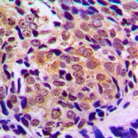 Histone Deacetylase 5/9 Rabbit Polyclonal Antibody