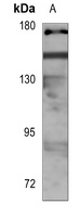 Histone Deacetylase 6 (Phospho-S22) Rabbit Polyclonal Antibody