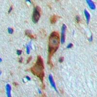 Histone Deacetylase 6 (Phospho-S22) Rabbit Polyclonal Antibody