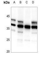 HDGFRP3 Rabbit Polyclonal Antibody