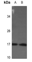 Histone H3 (Phospho-S28) Rabbit Polyclonal Antibody