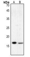 Histone H3 (Acetyl-K122) Antibody