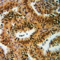 Histone H3 (Acetyl-K122) Antibody