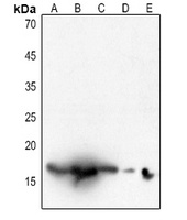 Histone H3 (Acetyl-K18) Antibody